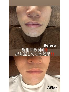 ケアアネラ(KeaAnela)/男性必見！