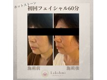 ラクシュミー(Lakshmi)の雰囲気（フェイシャル◎小顔になりたい方。頭痛や肩こりに悩まれる方にも）