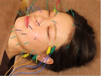 ビファイン鍼灸治療院 梅ヶ丘南口院/美容鍼