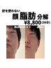 【頑固な顔のお肉に】針を使わない！顔脂肪分解5ml　¥8,800