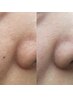 【毛穴洗浄】気軽に試したい方◎毛穴汚れ黒ずみスッキリ洗浄＋潤い美白パック