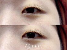 アンネ 伊丹店(ANNE)/【プレミアムラッシュリフト】