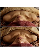 越前屋/ラジオ波で詰まりスッキリ