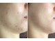 クレビア(CREBIA)の写真