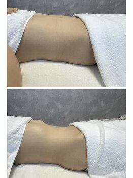 ビバ 島内店(VIVA)の写真/自律神経の土台をしっかり整えデトックス×免疫力UP！ぽっこりお腹や冷え・むくみ・便秘を徹底ケア◎
