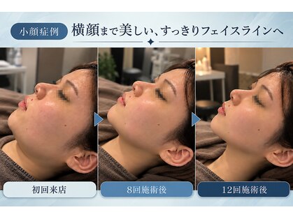 リフト 栄(Lift)の写真