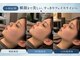 リフト 栄(Lift)の写真