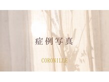 コロニラ(coronille)/エンダモロジーの効果