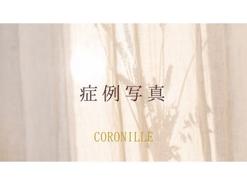 コロニラ(coronille)/エンダモロジーの効果