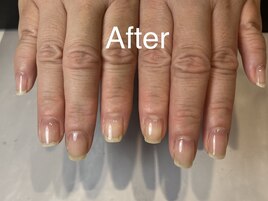 自爪育成★After