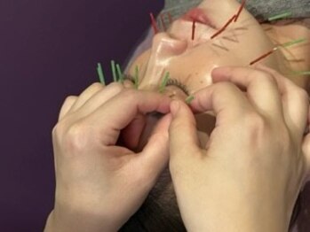 アディクト(Addict)/眼精疲労