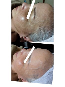 エクラ(eclat)/☆サロンケアとホームケア☆