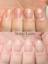 マリーロール 淀屋橋本店(Marie Laure)/自爪育成/深爪矯正/ネイルケア