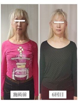 エクラ(eclat)/お客様の変化（正面）