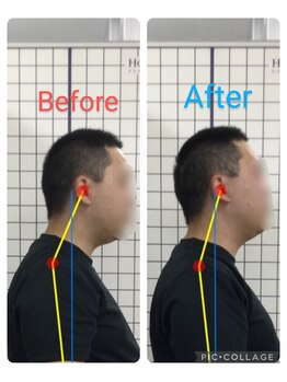 ボディメイク整体院 横浜駅西口店(BodyMake)/施術風景-首が辛い30代男性-
