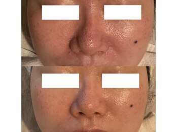 アンジェラックス 福岡天神店/