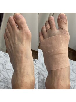 距骨サロン 東岡山店/【足裏、親指の痛み】東岡山