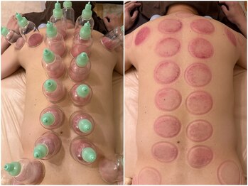 らく～だ 浜松町大門/カッピングしています