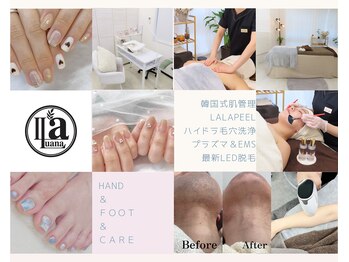 ラ ルアナ(La Luana)