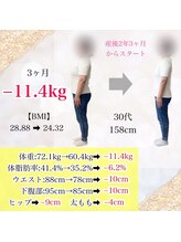 ベルソー鍼灸整体院(berceau鍼灸整体院)/30代女性産後ダイエットコース