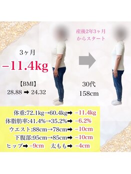 ベルソー鍼灸整体院(berceau鍼灸整体院)/30代女性産後ダイエットコース
