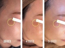 ギルドハナレ(GUILD HANARE)/"透明感のある肌へ"