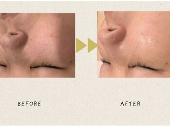 トゥーセブンネイルズ(TwoSevenNails)/before or after