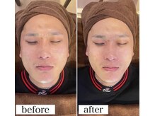 アンドワイ バイ サロンリーナ(&y by Salon Lena)の雰囲気（大人気！瞬時に小顔【大切なお客様の口コミもcheck】メンズもOK）