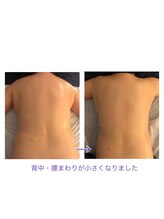 テールボーテ(Terre beaute)/背中がスッキリ☆