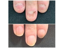 ハニーネイルビー(Honey nail bee)の雰囲気（噛み爪・むしり爪などの深爪も健康で健やかなお爪に）