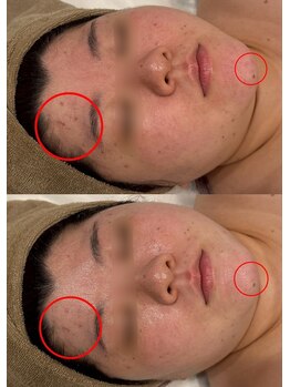 セレニテ(Serenite)/