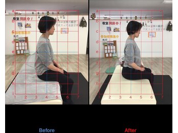 ストレチックス 近江八幡店/BeforeAfter