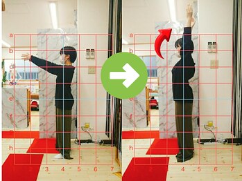 サプライズ整体院/20代ママさんの肩こり初回結果