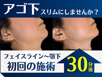 マイスター整体院 天神院の写真/小顔なら天神のフェイスライン専門院へ｜ほうれい線・たるみも一緒に【西鉄天神駅/天神南駅から徒歩3分】