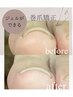 巻き爪解消！巻き爪矯正（両親指）+ジェルワンカラー￥12200（土日+550円）