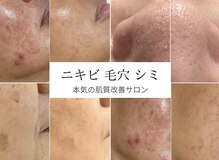 モッティ(MOTTY)