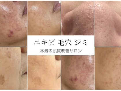 モッティ(MOTTY)の写真