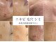 モッティ(MOTTY)の写真