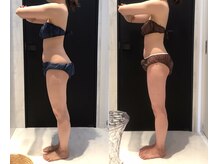 リボディ 表参道(An re Body)/before→after