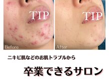 ユク(Yuk)の雰囲気（お悩みや肌質によって、完全オーダーメイドのハーブピーリング♪）