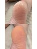 定額フット＋角質ケア付きクーポン