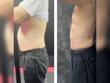 デトックススパボディーラボの雰囲気（ダウンタイム無!リバウンド無!確実に脂肪を減らしてく脂肪分解☆）