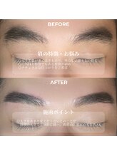 クリル(Kuril)/ビフォーアフター30代男性♪