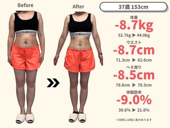 ニドム/37歳　-8kg産後痩身ダイエット1