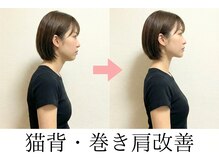 ニュートラル 渋谷店(NEUTRAL)/ストレートネックは現代病