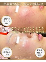 ソユ(SOYOU)/施術* &nbsp;&nbsp;&nbsp;ララピール×フォト