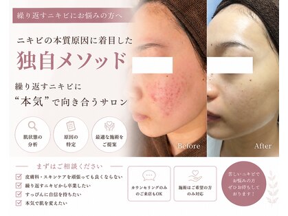リセラ エン イズモ(recella en izumo)の写真