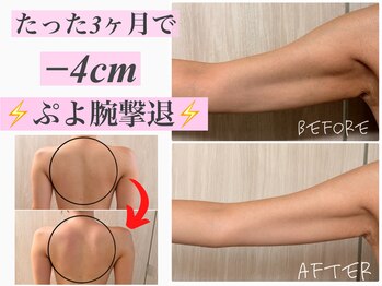 バービーグロウ 恵比寿(Barbie Glow)の写真/圧倒的結果に感動…変わりたいプヨ二の腕・ハミ背中~のお悩みを最短最速で改善!夏までに魅せお腹ゲット!