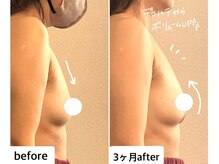 つばききよら/５０代でもバストアップ♪