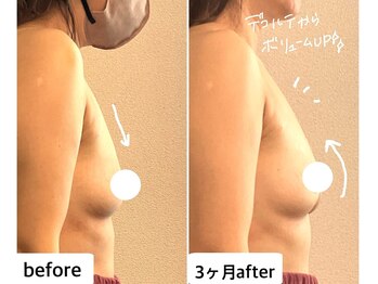 つばききよら/５０代でもバストアップ♪